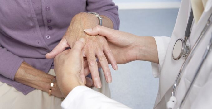 Effective Ways to Take Care of an Arthritis Patient