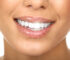 Improving Your Smile With Invisalign ─ Advantages of Invisalign Treatment