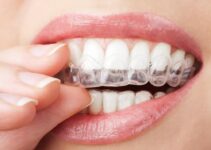 ClearCorrect Vs. Invisalign: Understanding The Differences And Similarities 